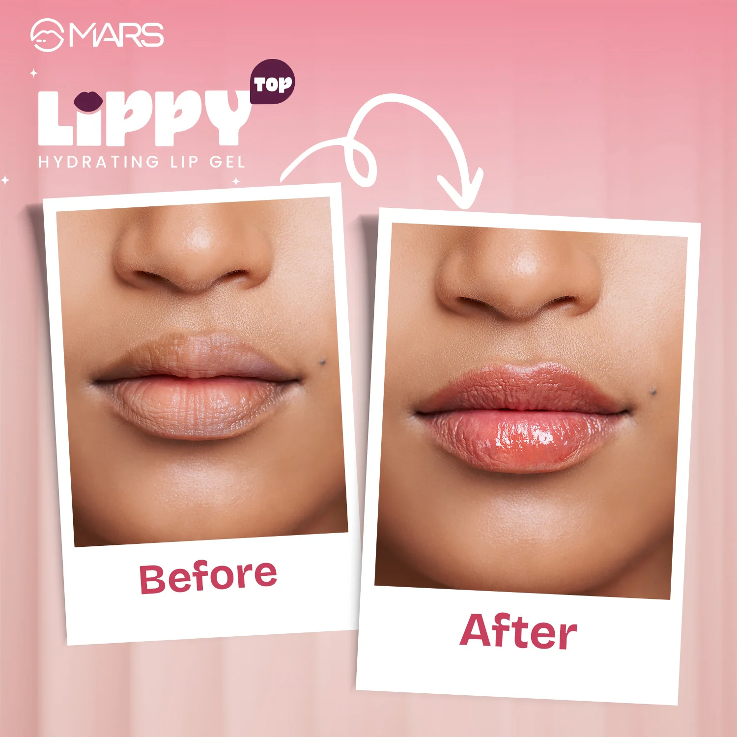 Lippy Top | Hydrating Lip Gel - Image 7